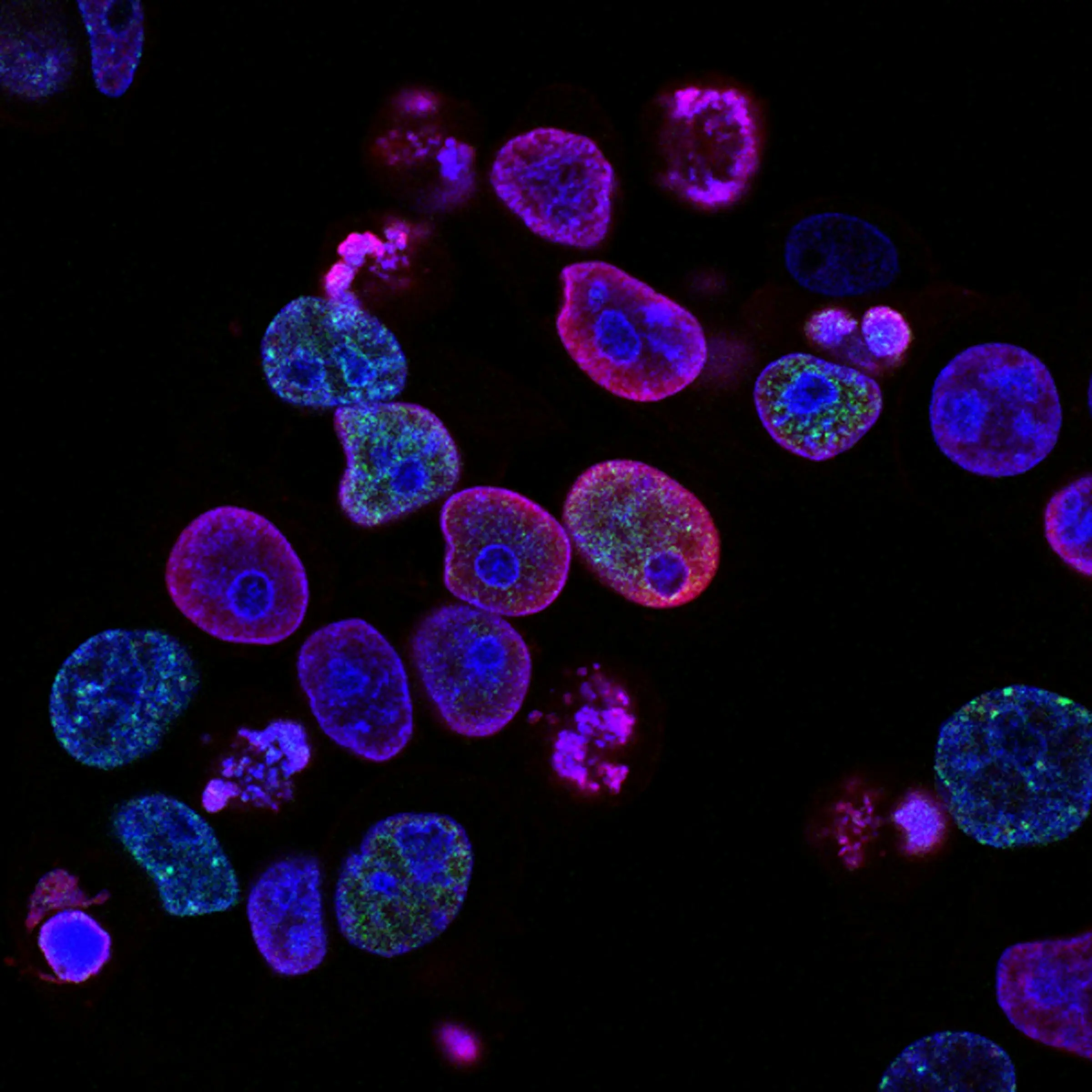 Fluorescent microscopy of living cells in magenta and blue